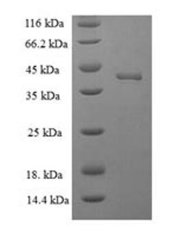 (Tris-Glycine gel) Discontinuous SDS-PAGE (reduced) with 5% enrichment gel and 15% separation gel.