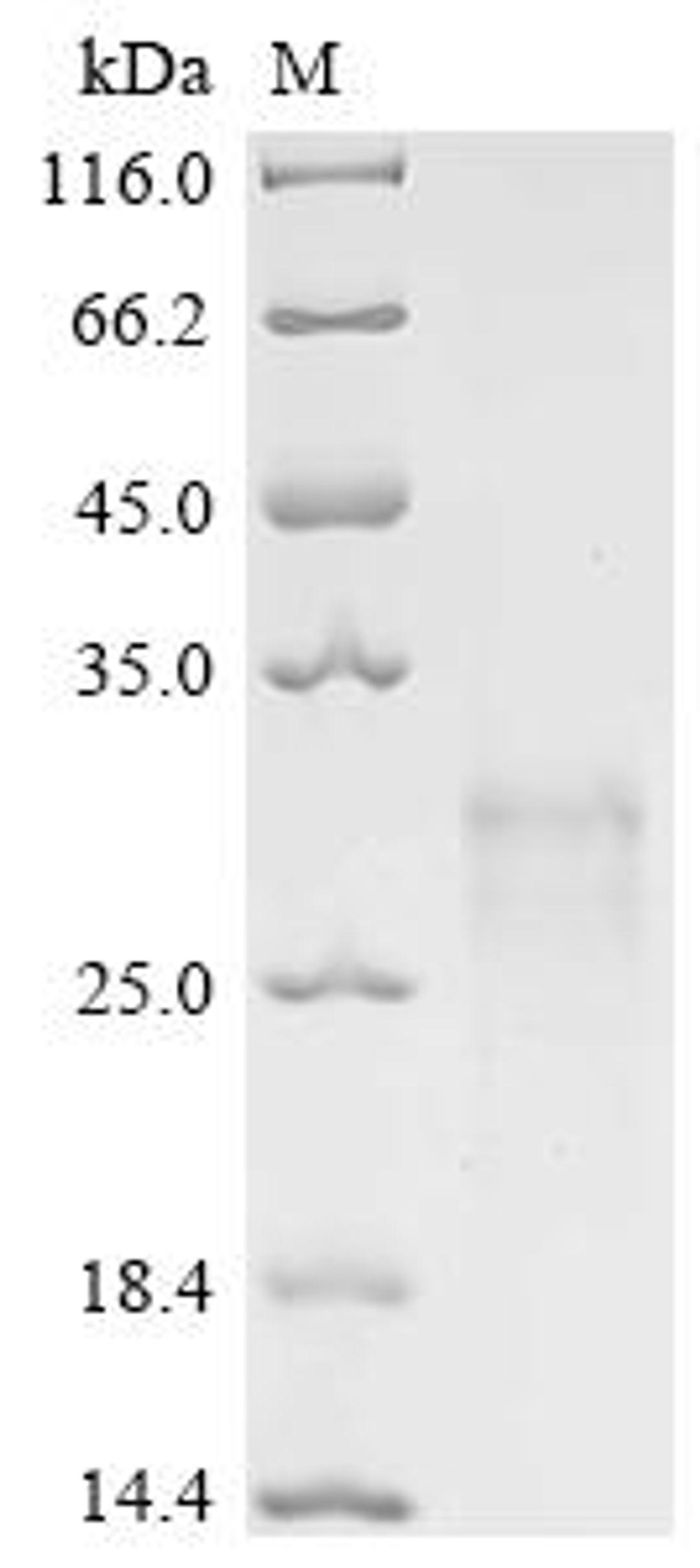 (Tris-Glycine gel) Discontinuous SDS-PAGE (reduced) with 5% enrichment gel and 15% separation gel.