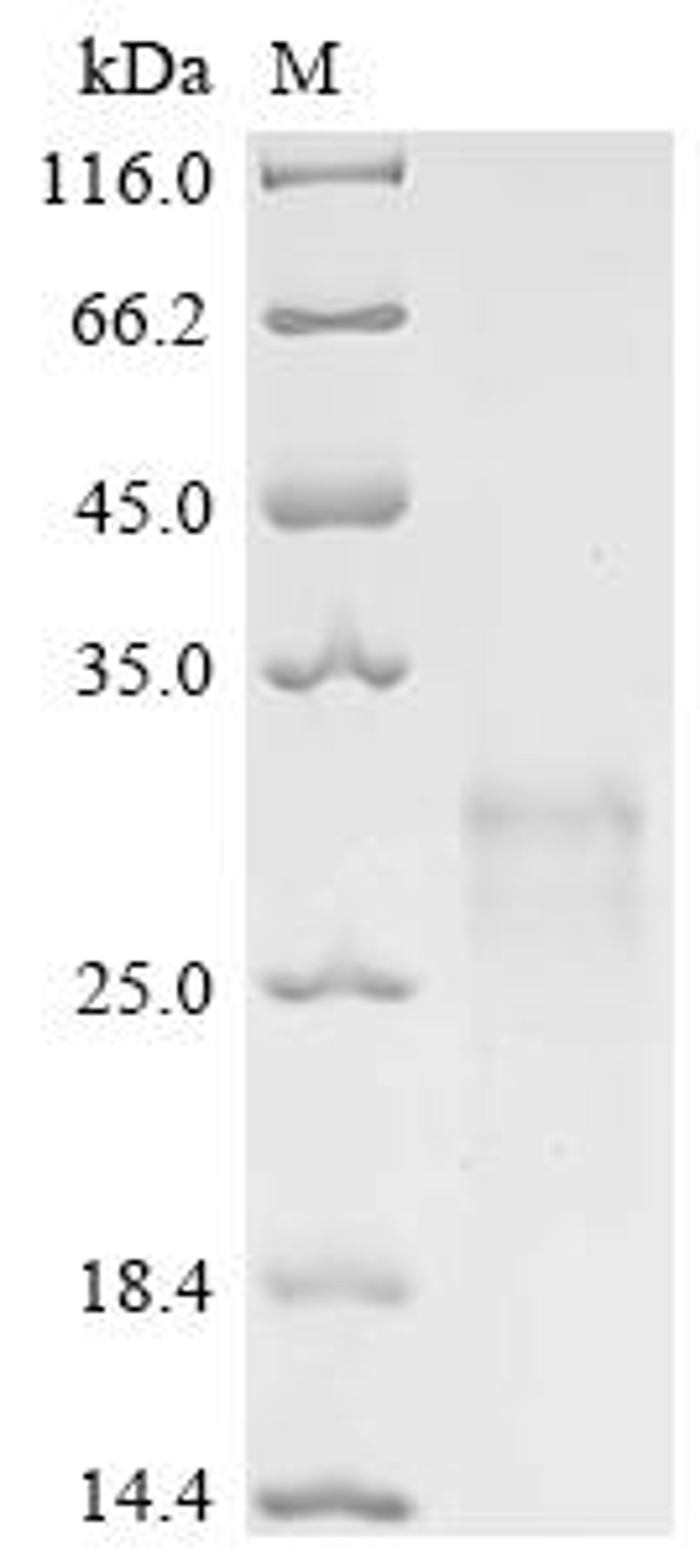 (Tris-Glycine gel) Discontinuous SDS-PAGE (reduced) with 5% enrichment gel and 15% separation gel.