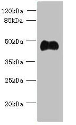 Western blot. All lanes: ABI3 antibody at 5ug/ml + Mouse heart tissue. Secondary. Goat polyclonal to rabbit IgG at 1/10000 dilution. Predicted band size: 40, 39 kDa. Observed band size: 40 kDa. 