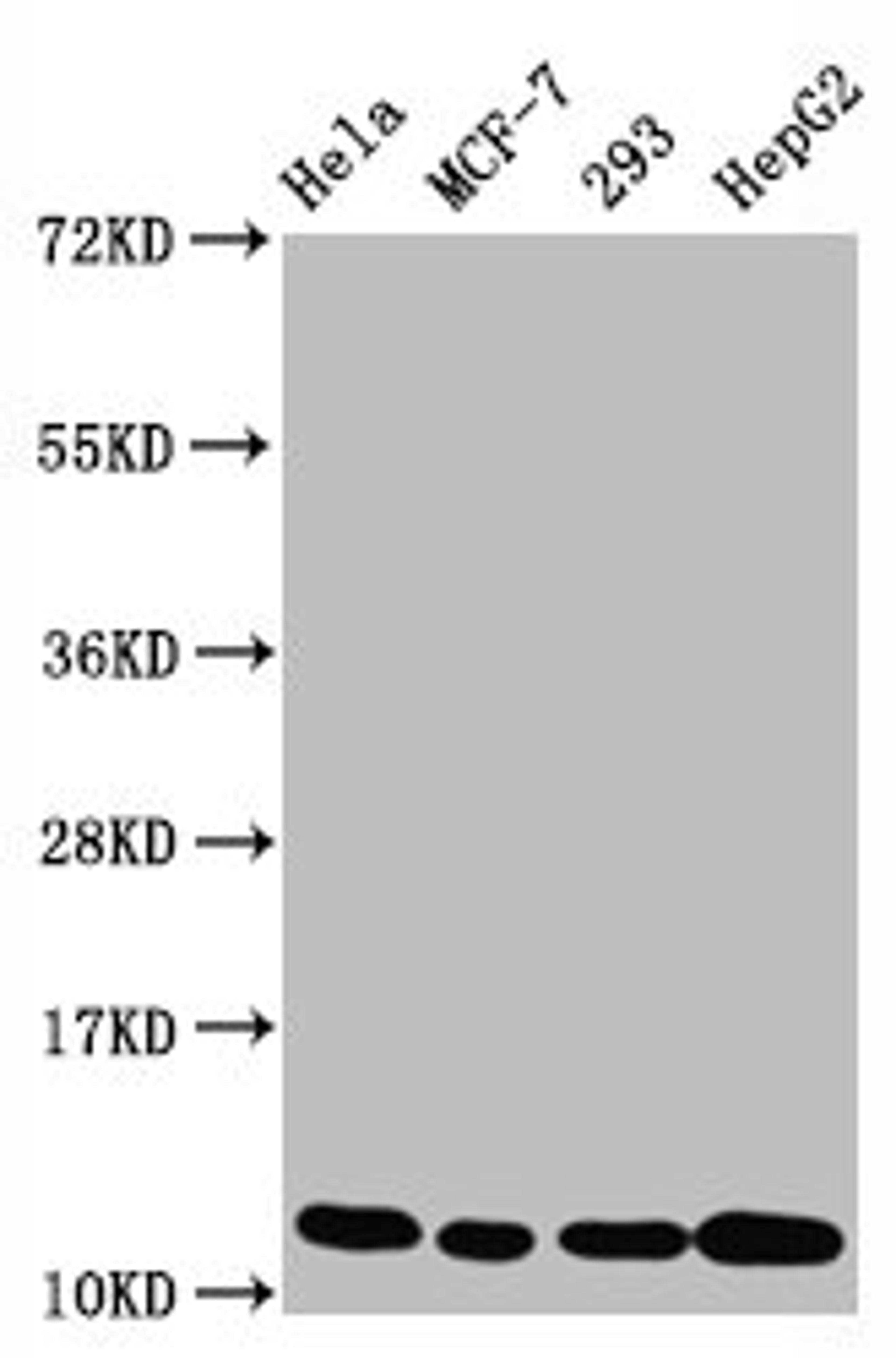 Western Blot. Positive WB detected in Hela whole cell lysate锛孧CF-7 whole cell lysate锛?93 whole cell lysate锛孒epG2 whole cell lysate. All lanes Acetyl-Histone H4 (K5) antibody at 1.05μg/ml. Secondary. Goat polyclonal to rabbit IgG at 1/50000 dilution. Predicted band size: 11 KDa. Observed band size: 11 KDa. 