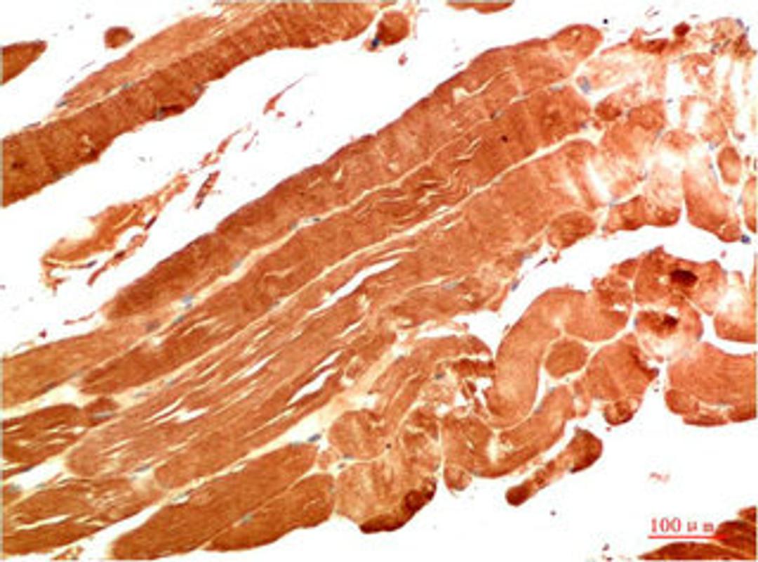 Immunohistochemical analysis of paraffin-embedded Human Skeletal Muscle Tissue using NBR1  Mouse mAb diluted at 1:200.