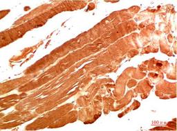 Immunohistochemical analysis of paraffin-embedded Human Skeletal Muscle Tissue using NBR1  Mouse mAb diluted at 1:200.