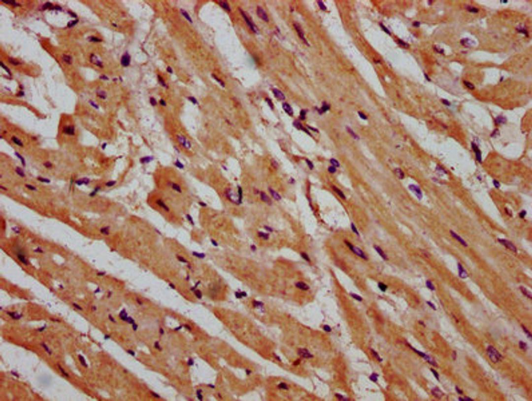 IHC image of CSB-PA615679LA01HU diluted at 1:600 and staining in paraffin-embedded human heart tissue performed on a Leica BondTM system. After dewaxing and hydration, antigen retrieval was mediated by high pressure in a citrate buffer (pH 6.0). Section was blocked with 10% normal goat serum 30min at RT. Then primary antibody (1% BSA) was incubated at 4&deg;C overnight. The primary is detected by a biotinylated secondary antibody and visualized using an HRP conjugated SP system.