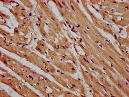 IHC image of CSB-PA615679LA01HU diluted at 1:600 and staining in paraffin-embedded human heart tissue performed on a Leica BondTM system. After dewaxing and hydration, antigen retrieval was mediated by high pressure in a citrate buffer (pH 6.0). Section was blocked with 10% normal goat serum 30min at RT. Then primary antibody (1% BSA) was incubated at 4&deg;C overnight. The primary is detected by a biotinylated secondary antibody and visualized using an HRP conjugated SP system.