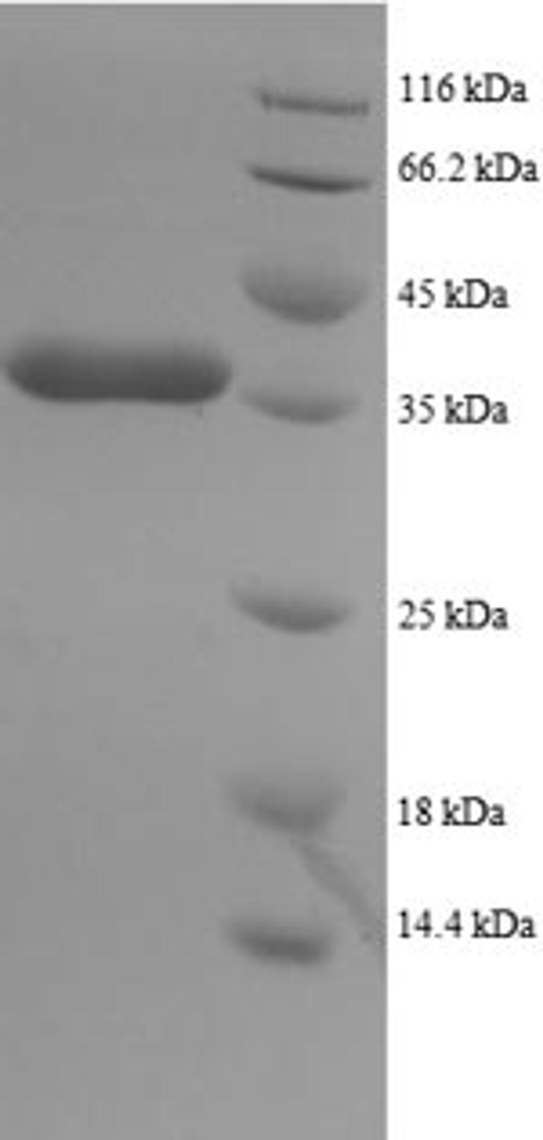 (Tris-Glycine gel) Discontinuous SDS-PAGE (reduced) with 5% enrichment gel and 15% separation gel.