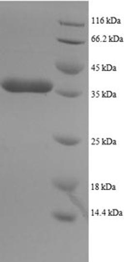 (Tris-Glycine gel) Discontinuous SDS-PAGE (reduced) with 5% enrichment gel and 15% separation gel.