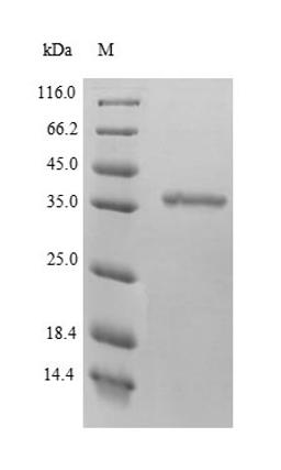 (Tris-Glycine gel) Discontinuous SDS-PAGE (reduced) with 5% enrichment gel and 15% separation gel.