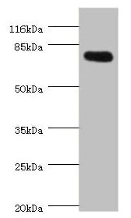 Western blot. All lanes: SH2B1 antibody at 0.81ug/ml + 293T whole cell lysate. Secondary. Goat polyclonal to rabbit IgG at 1/10000 dilution. Predicted band size: 80, 71, 73 kDa. Observed band size: 80 kDa. 