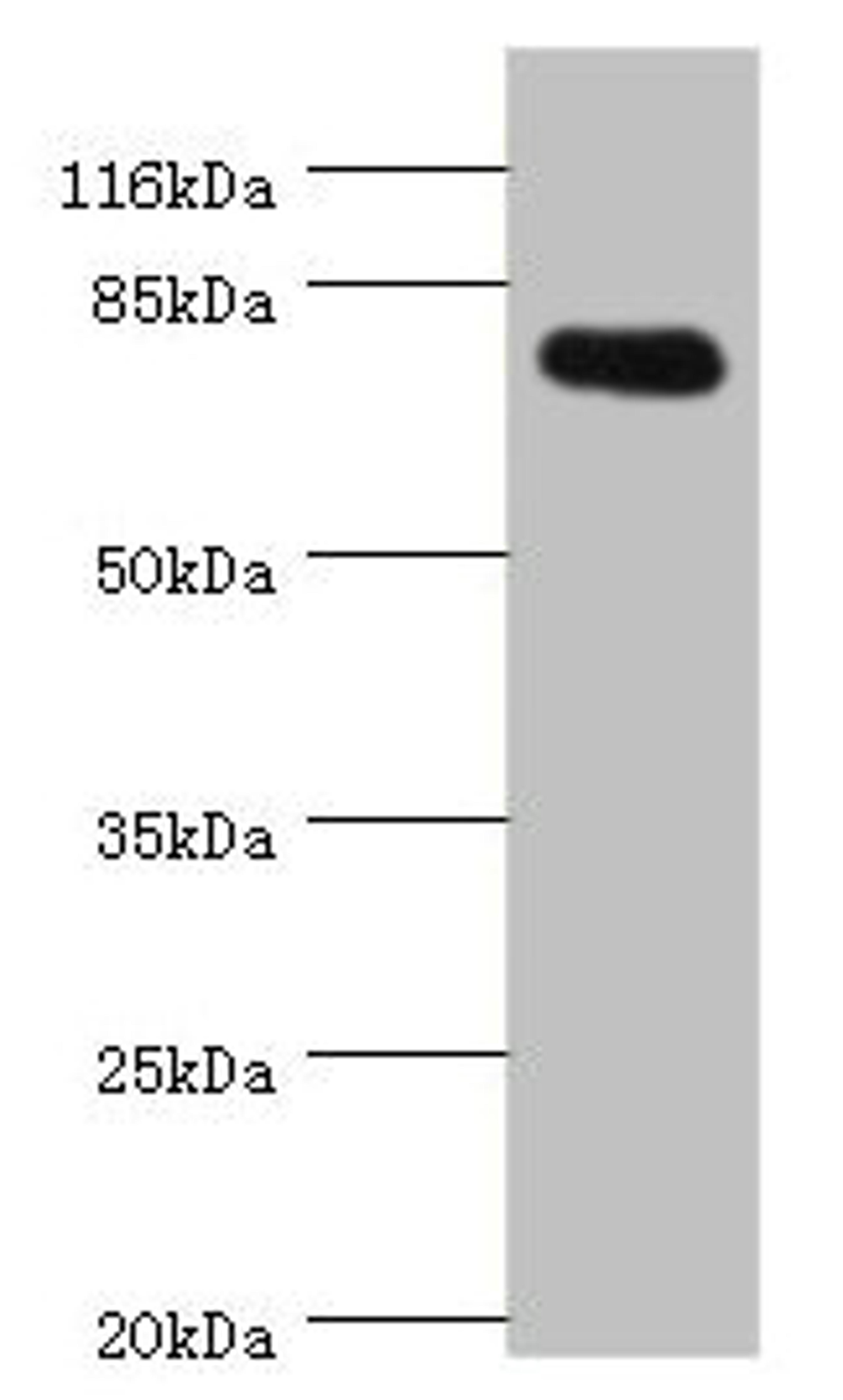 Western blot. All lanes: SH2B1 antibody at 0.81ug/ml + 293T whole cell lysate. Secondary. Goat polyclonal to rabbit IgG at 1/10000 dilution. Predicted band size: 80, 71, 73 kDa. Observed band size: 80 kDa. 