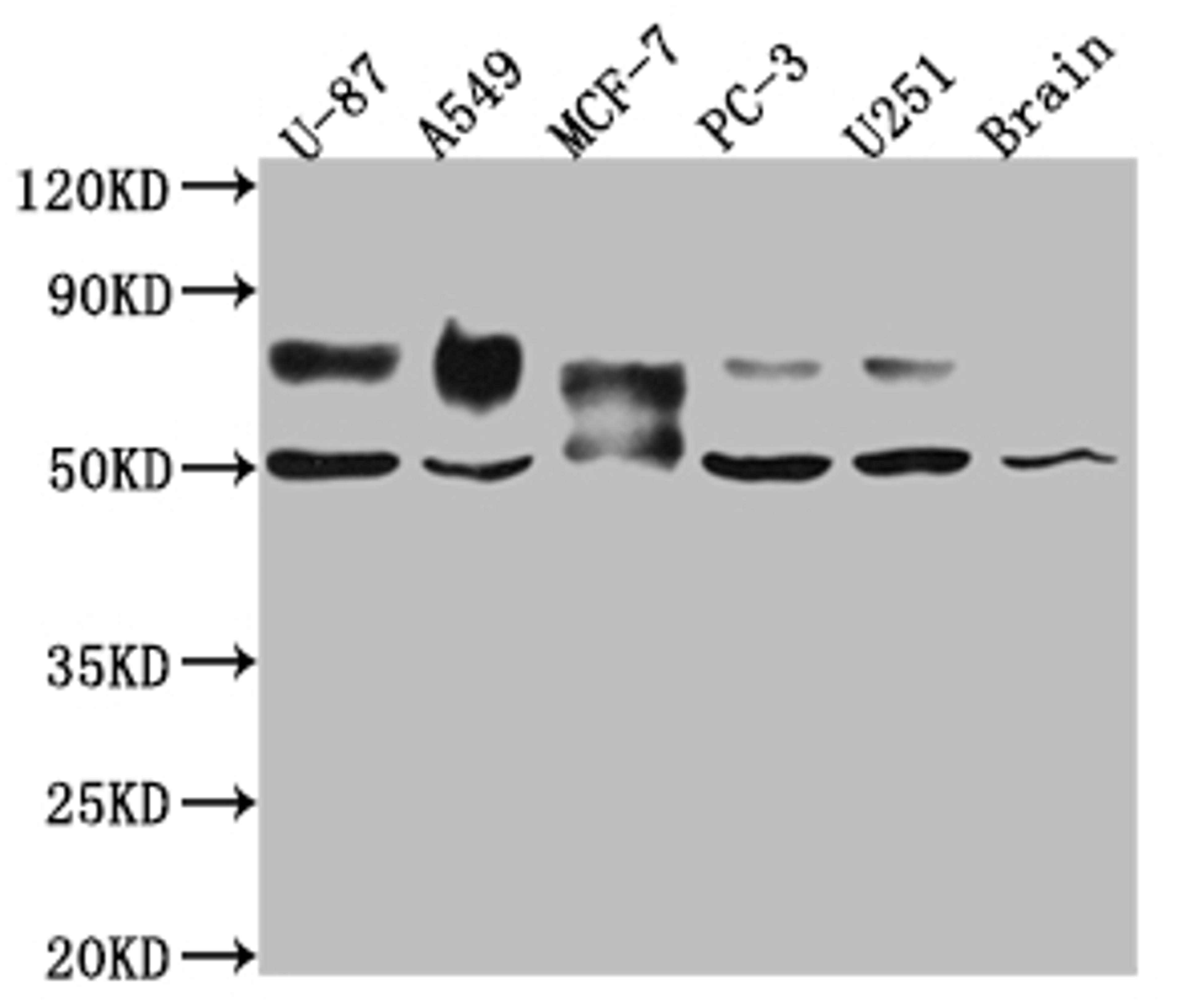 Western Blot. Positive WB detected in: U-87 whole cell lysate, A549 whole cell lysate, MCF-7 whole cell lysate, PC-3 whole cell lysate, U-251 whole cell lysate, Mouse Brain whole cell lysate. All lanes: 5T4 antibody at 1:1000. Secondary. Goat polyclonal to rabbit IgG at 1/50000 dilution. Predicted band size: 47 kDa. Observed band size: 50, 80 kDa.