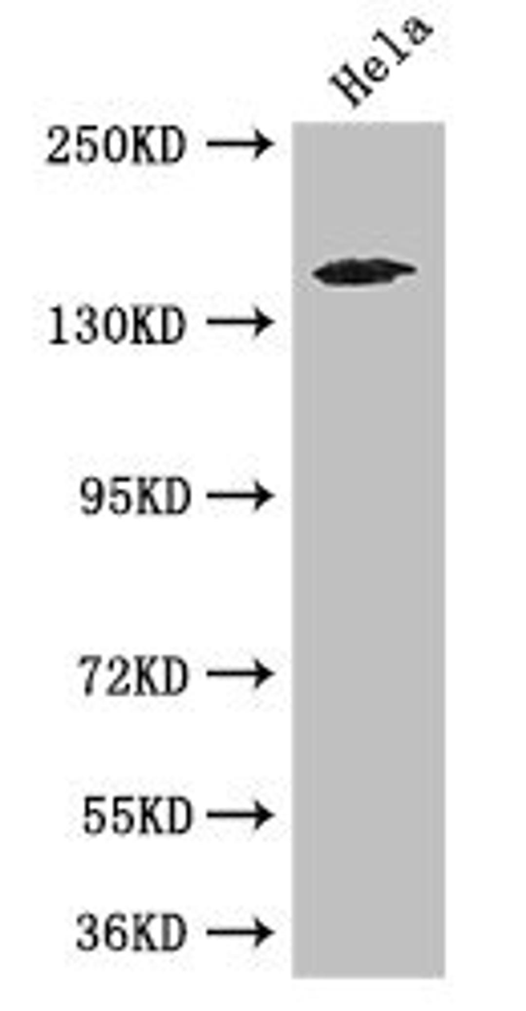 Western Blot. Positive WB detected in: Hela whole cell lysate. All lanes: TNRC6C antibody at 3.4ug/ml. Secondary. Goat polyclonal to rabbit IgG at 1/50000 dilution. Predicted band size: 176, 180 kDa. Observed band size: 176 kDa. 