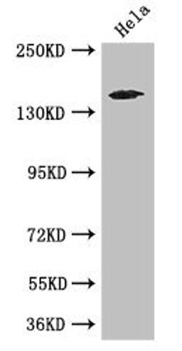 Western Blot. Positive WB detected in: Hela whole cell lysate. All lanes: TNRC6C antibody at 3.4ug/ml. Secondary. Goat polyclonal to rabbit IgG at 1/50000 dilution. Predicted band size: 176, 180 kDa. Observed band size: 176 kDa. 
