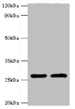 Western blot. All lanes: ACRV1 antibody at 4ug/ml. Lane 1: Mouse liver tissue. Lane 2: Mouse gonad tissue. Secondary. Goat polyclonal to rabbit IgG at 1/10000 dilution. Predicted band size: 29, 27, 23, 21, 20, 19, 18, 17, 14, 9 kDa. Observed band size: 29 kDa. 