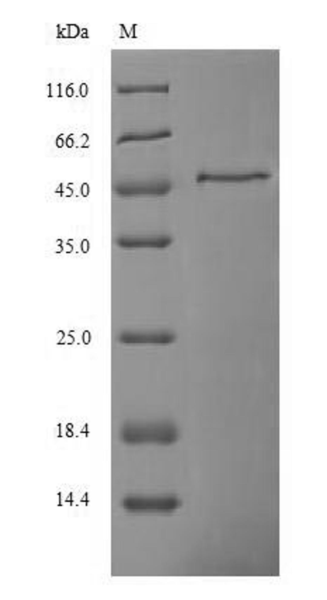 (Tris-Glycine gel) Discontinuous SDS-PAGE (reduced) with 5% enrichment gel and 15% separation gel.