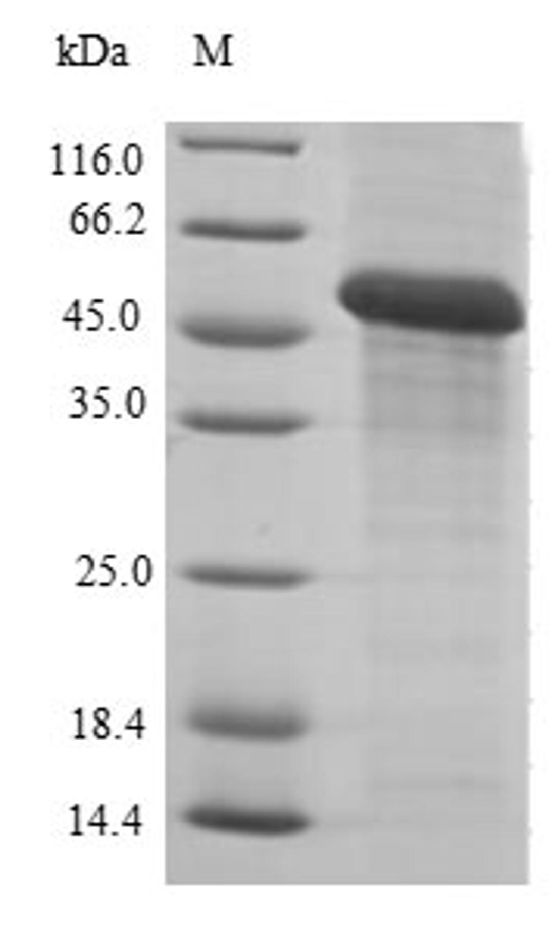 (Tris-Glycine gel) Discontinuous SDS-PAGE (reduced) with 5% enrichment gel and 15% separation gel.