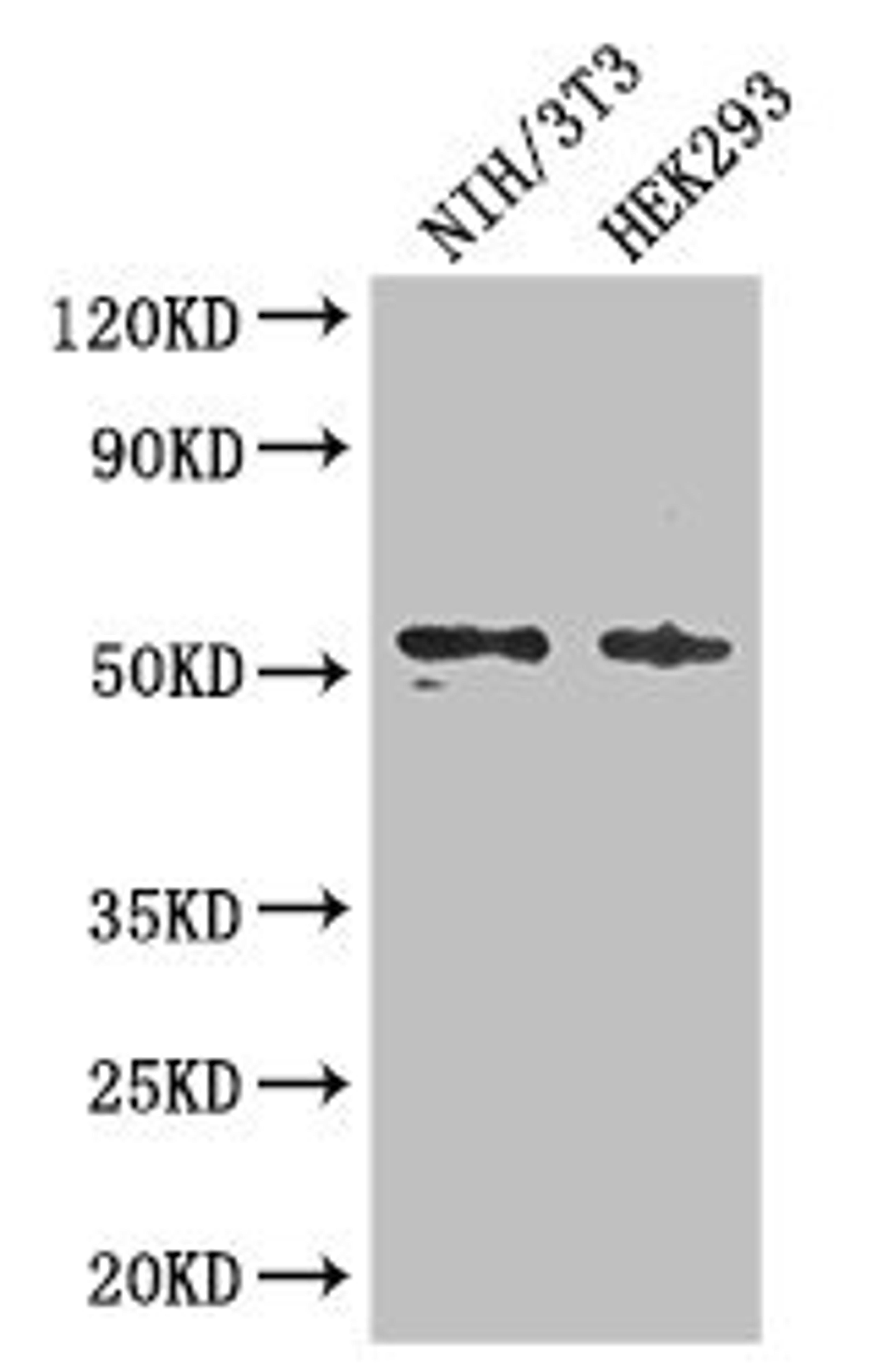 Western Blot. Positive WB detected in: NIH/3T3 whole cell lysate, HEK293 whole cell lysate. All lanes: RTCB antibody at 3ug/ml. Secondary. Goat polyclonal to rabbit IgG at 1/50000 dilution. Predicted band size: 56 kDa. Observed band size: 56 kDa. 