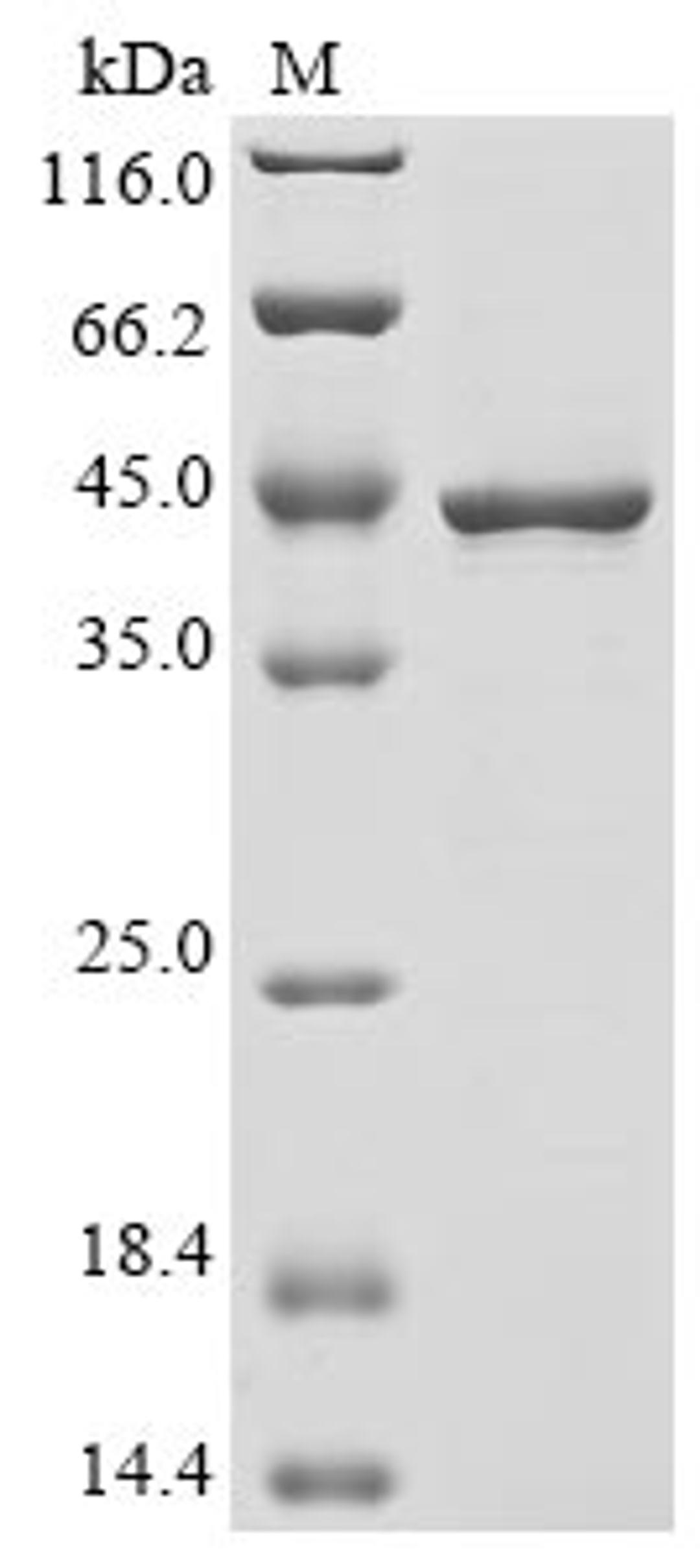 (Tris-Glycine gel) Discontinuous SDS-PAGE (reduced) with 5% enrichment gel and 15% separation gel.