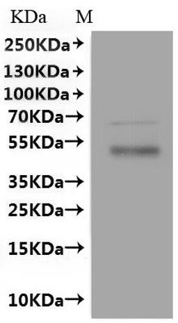 CSB-MP021412HU(A4) is detected by Mouse anti-6*His monoclonal antibody.