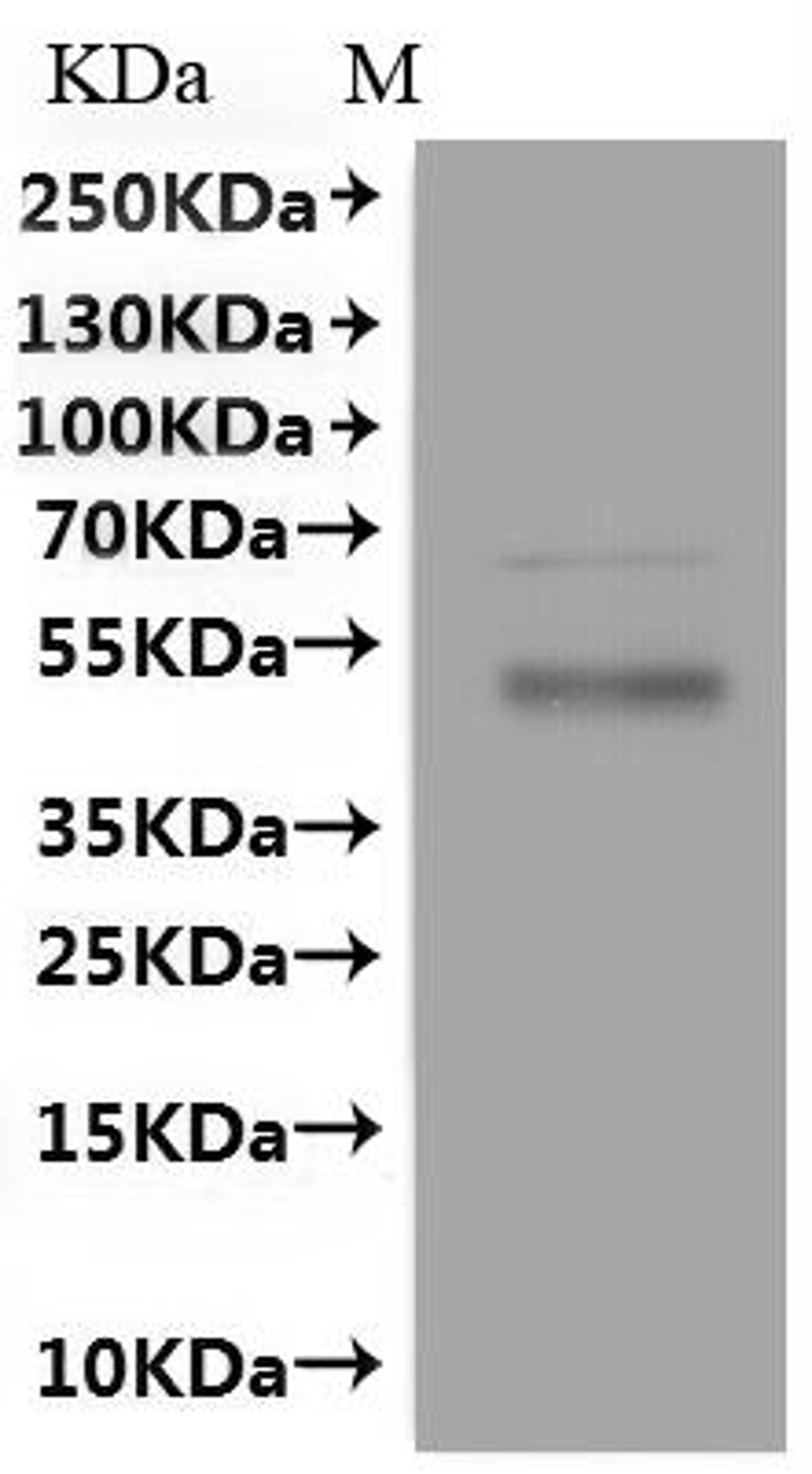 CSB-MP021412HU(A4) is detected by Mouse anti-6*His monoclonal antibody.