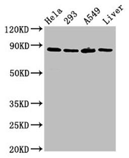 Western Blot. Positive WB detected in: Hela whole cell lysate, 293 whole cell lysate, A549 whole cell lysate, Rat liver tissue. All lanes: USP10 antibody at 3ug/ml. Secondary. Goat polyclonal to rabbit IgG at 1/50000 dilution. Predicted band size: 88, 93 kDa. Observed band size: 88 kDa. 