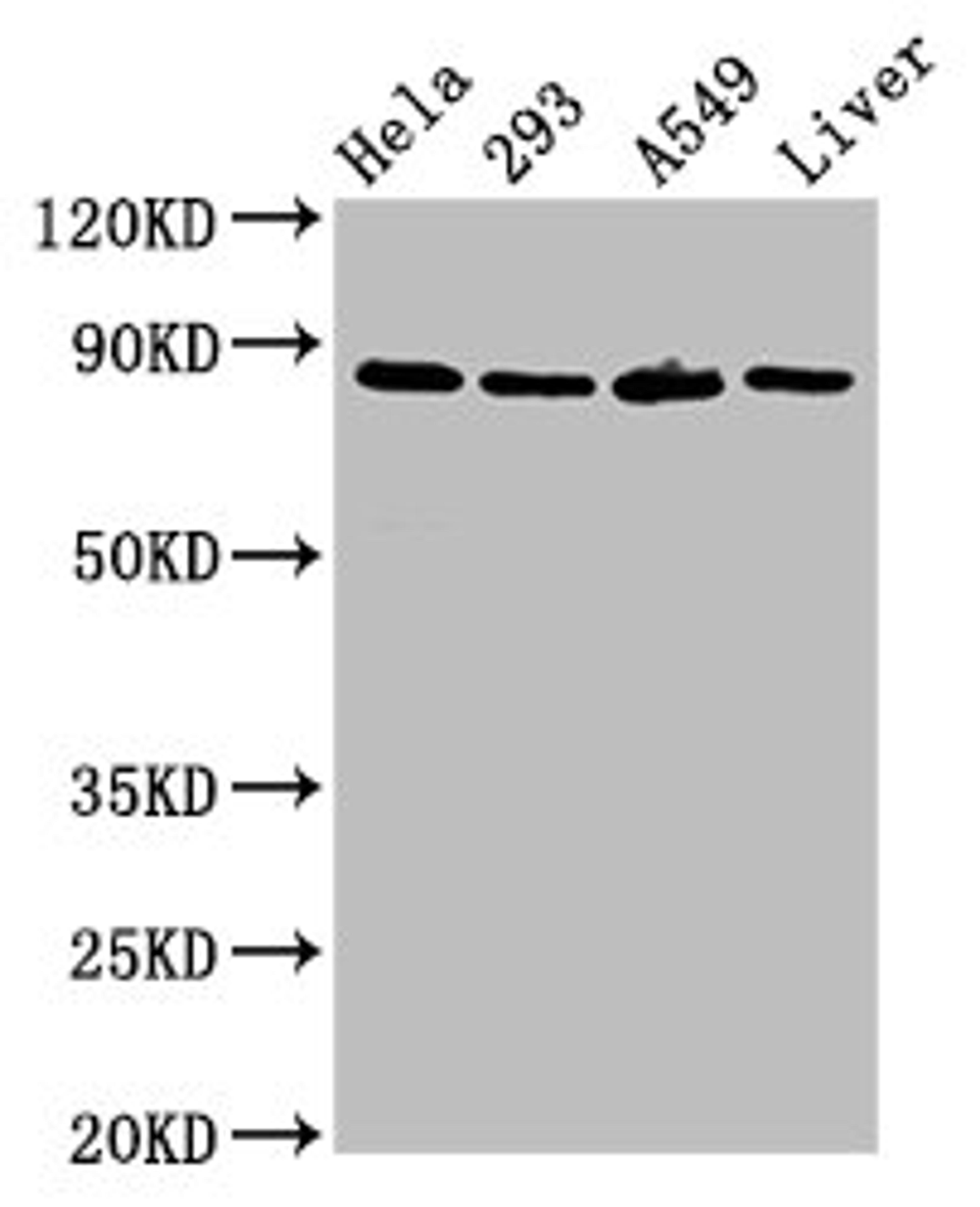 Western Blot. Positive WB detected in: Hela whole cell lysate, 293 whole cell lysate, A549 whole cell lysate, Rat liver tissue. All lanes: USP10 antibody at 3ug/ml. Secondary. Goat polyclonal to rabbit IgG at 1/50000 dilution. Predicted band size: 88, 93 kDa. Observed band size: 88 kDa.