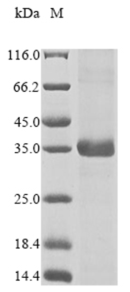 (Tris-Glycine gel) Discontinuous SDS-PAGE (reduced) with 5% enrichment gel and 15% separation gel.