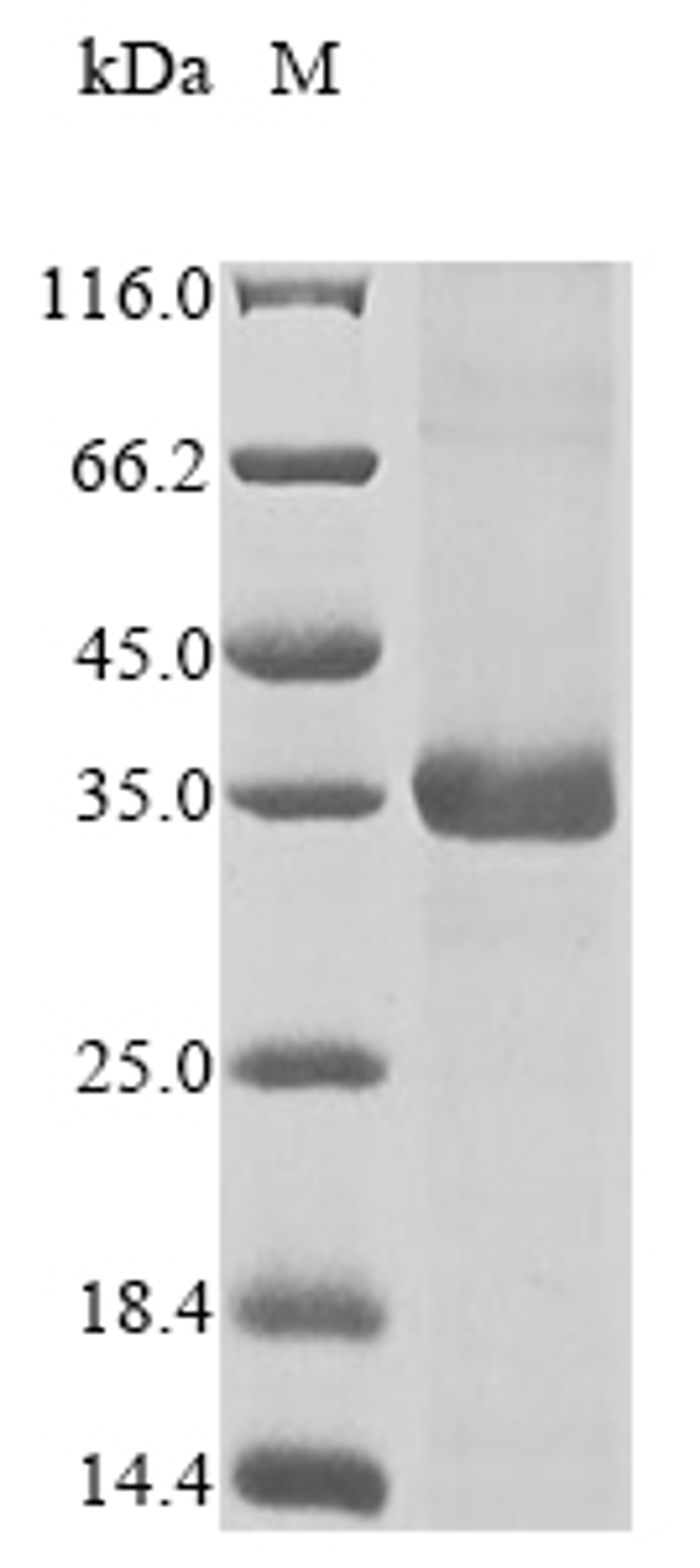 (Tris-Glycine gel) Discontinuous SDS-PAGE (reduced) with 5% enrichment gel and 15% separation gel.