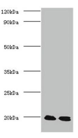 Western blot. All lanes: Protein DJ-1 antibody at 2ug/ml. Lane 1: EC109 whole cell lysate. Lane 2: 293T whole cell lysate. Secondary. Goat polyclonal to Rabbit IgG at 1/15000 dilution. Predicted band size: 20 kDa. Observed band size: 20 kDa. 