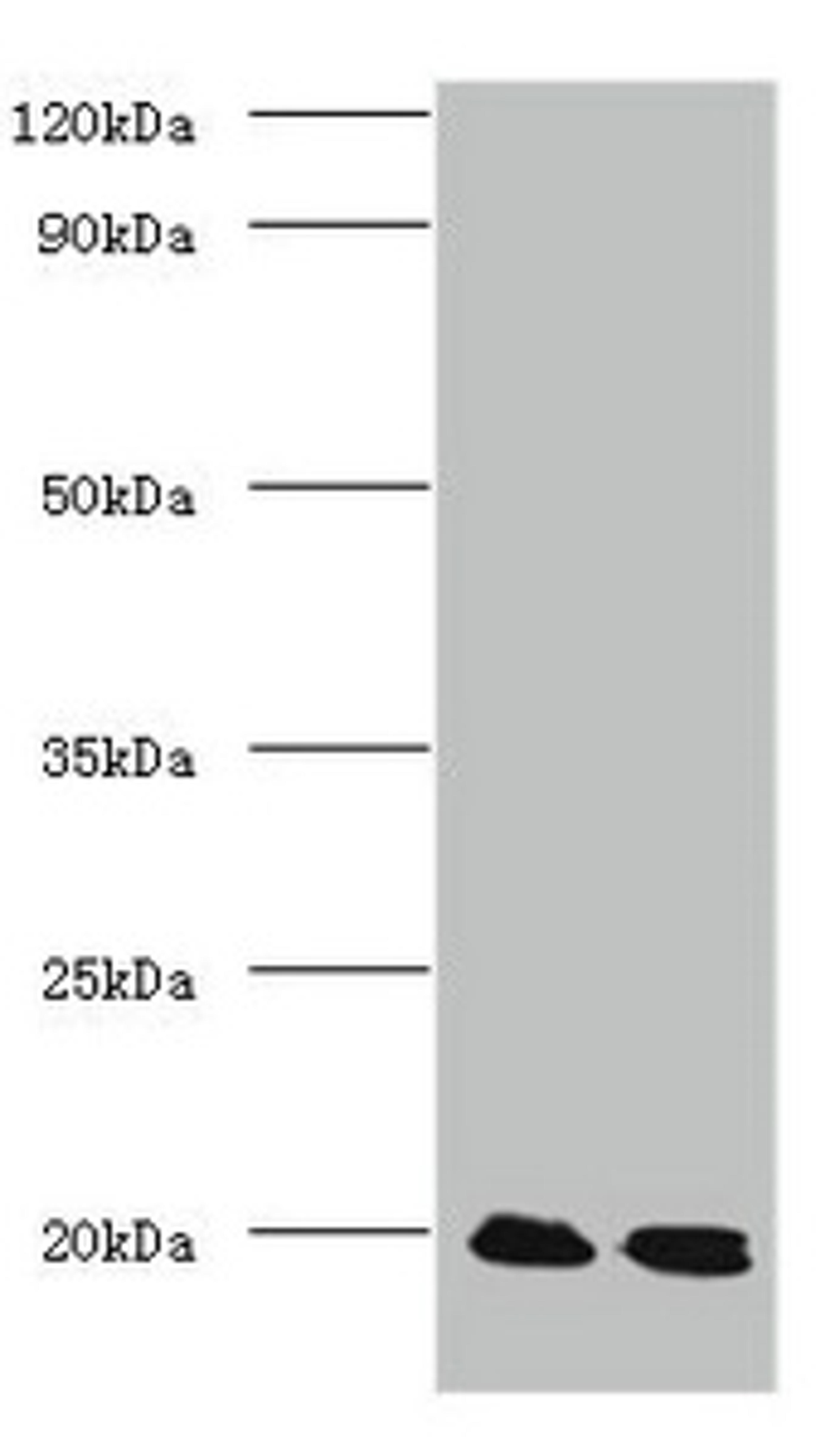 Western blot. All lanes: Protein DJ-1 antibody at 2ug/ml. Lane 1: EC109 whole cell lysate. Lane 2: 293T whole cell lysate. Secondary. Goat polyclonal to Rabbit IgG at 1/15000 dilution. Predicted band size: 20 kDa. Observed band size: 20 kDa. 