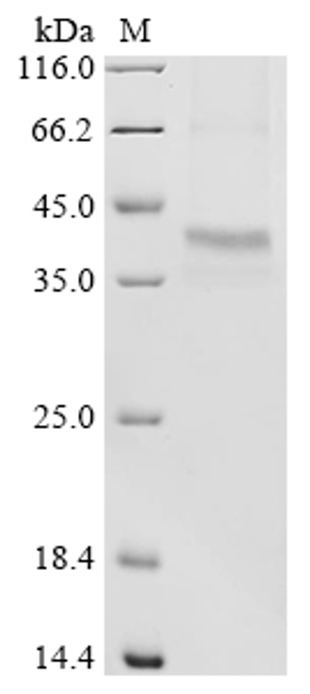 (Tris-Glycine gel) Discontinuous SDS-PAGE (reduced) with 5% enrichment gel and 15% separation gel.