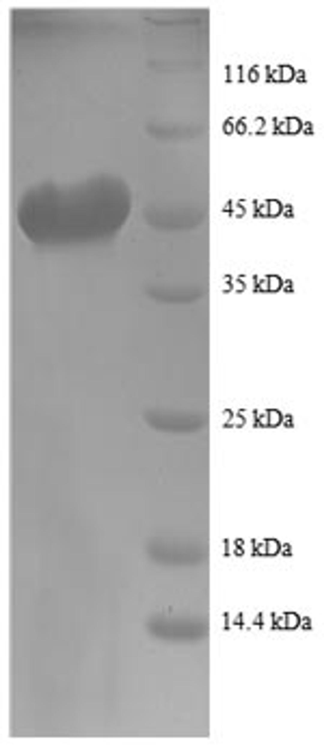 (Tris-Glycine gel) Discontinuous SDS-PAGE (reduced) with 5% enrichment gel and 15% separation gel.