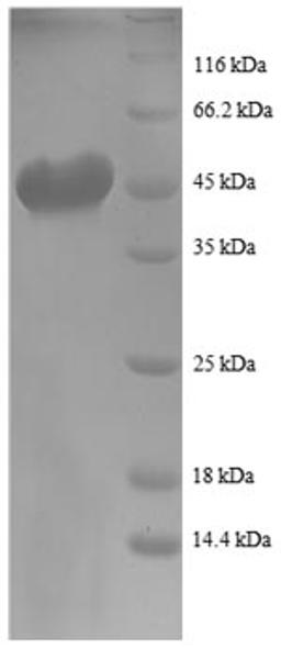 (Tris-Glycine gel) Discontinuous SDS-PAGE (reduced) with 5% enrichment gel and 15% separation gel.