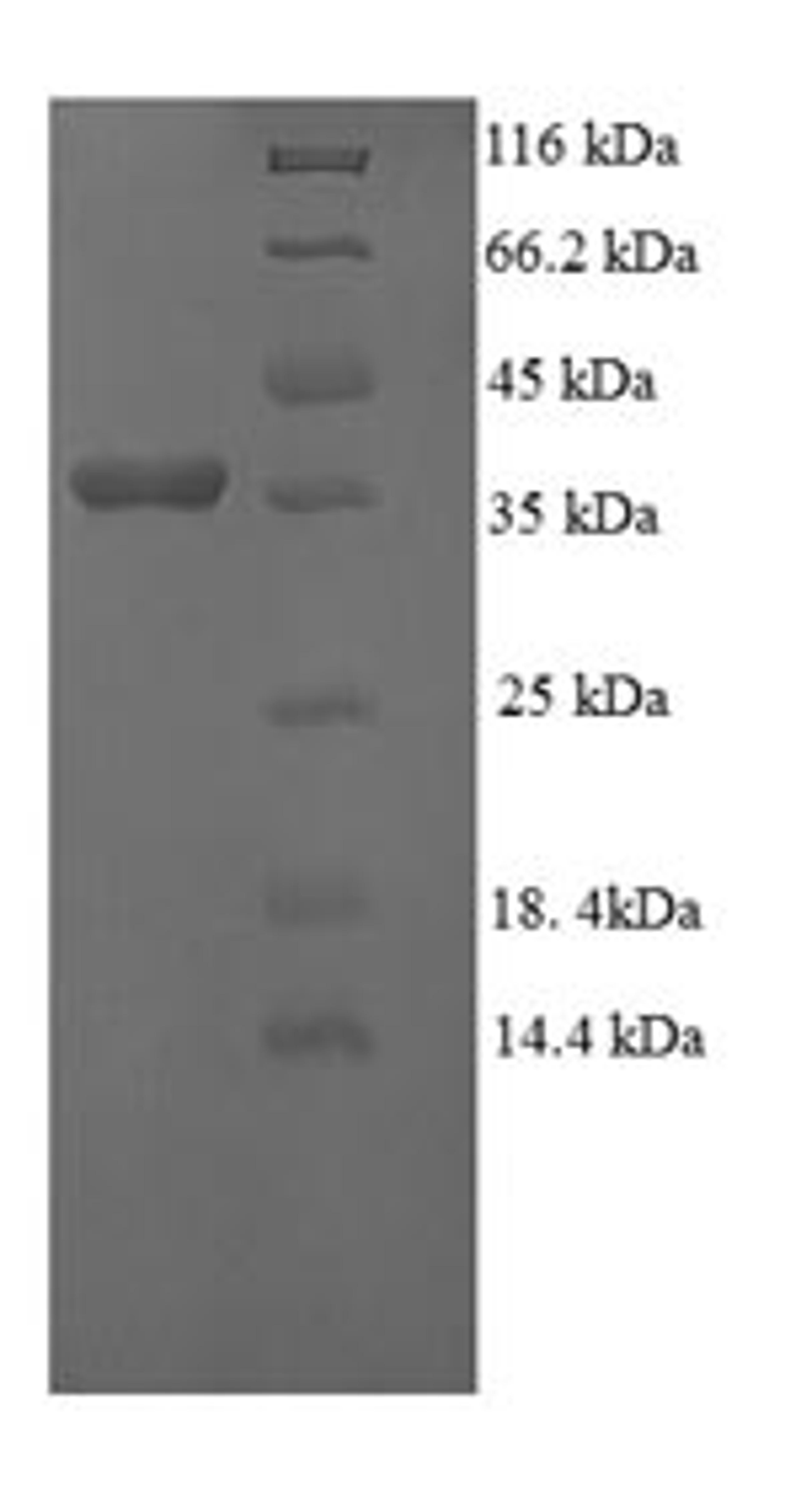 (Tris-Glycine gel) Discontinuous SDS-PAGE (reduced) with 5% enrichment gel and 15% separation gel.