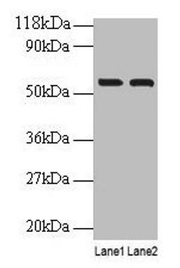 Western blot. All lanes: IMPDH2 antibody at 2µg/ml. Lane 1: EC109 whole cell lysate. Lane 2: 293T whole cell lysate. Secondary. Goat polyclonal to rabbit IgG at 1/15000 dilution. Predicted band size: 56 kDa. Observed band size: 56 kDa