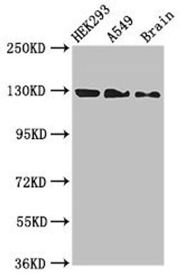 Western Blot. Positive WB detected in: HEK293 whole cell lysate, A549 whole cell lysate, Mouse brain tissue. All lanes: EIF4ENIF1 antibody at 2.7µg/ml. Secondary. Goat polyclonal to rabbit IgG at 1/50000 dilution. Predicted band size: 109, 89 kDa. Observed band size: 130 kDa