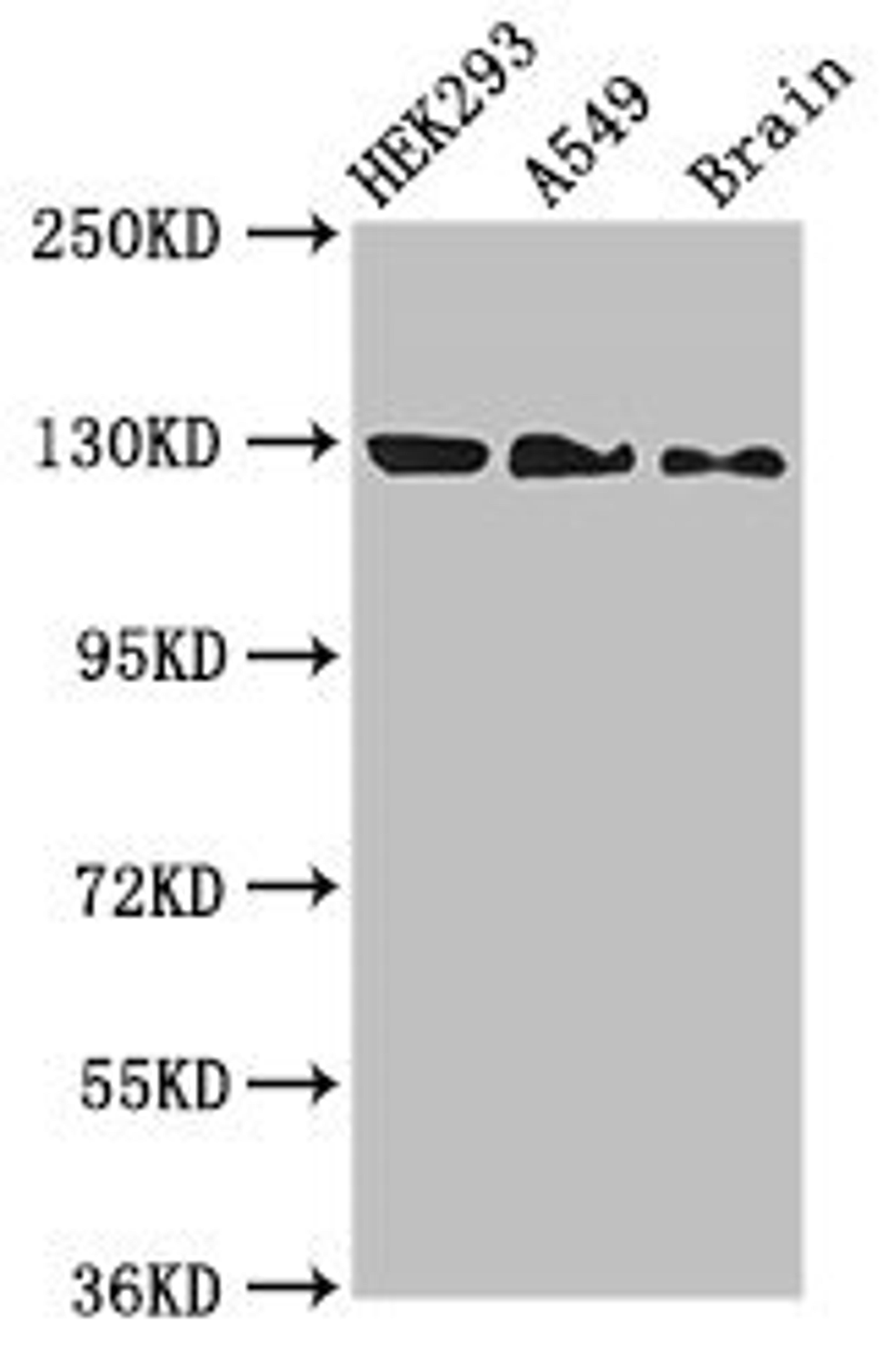 Western Blot. Positive WB detected in: HEK293 whole cell lysate, A549 whole cell lysate, Mouse brain tissue. All lanes: EIF4ENIF1 antibody at 2.7µg/ml. Secondary. Goat polyclonal to rabbit IgG at 1/50000 dilution. Predicted band size: 109, 89 kDa. Observed band size: 130 kDa