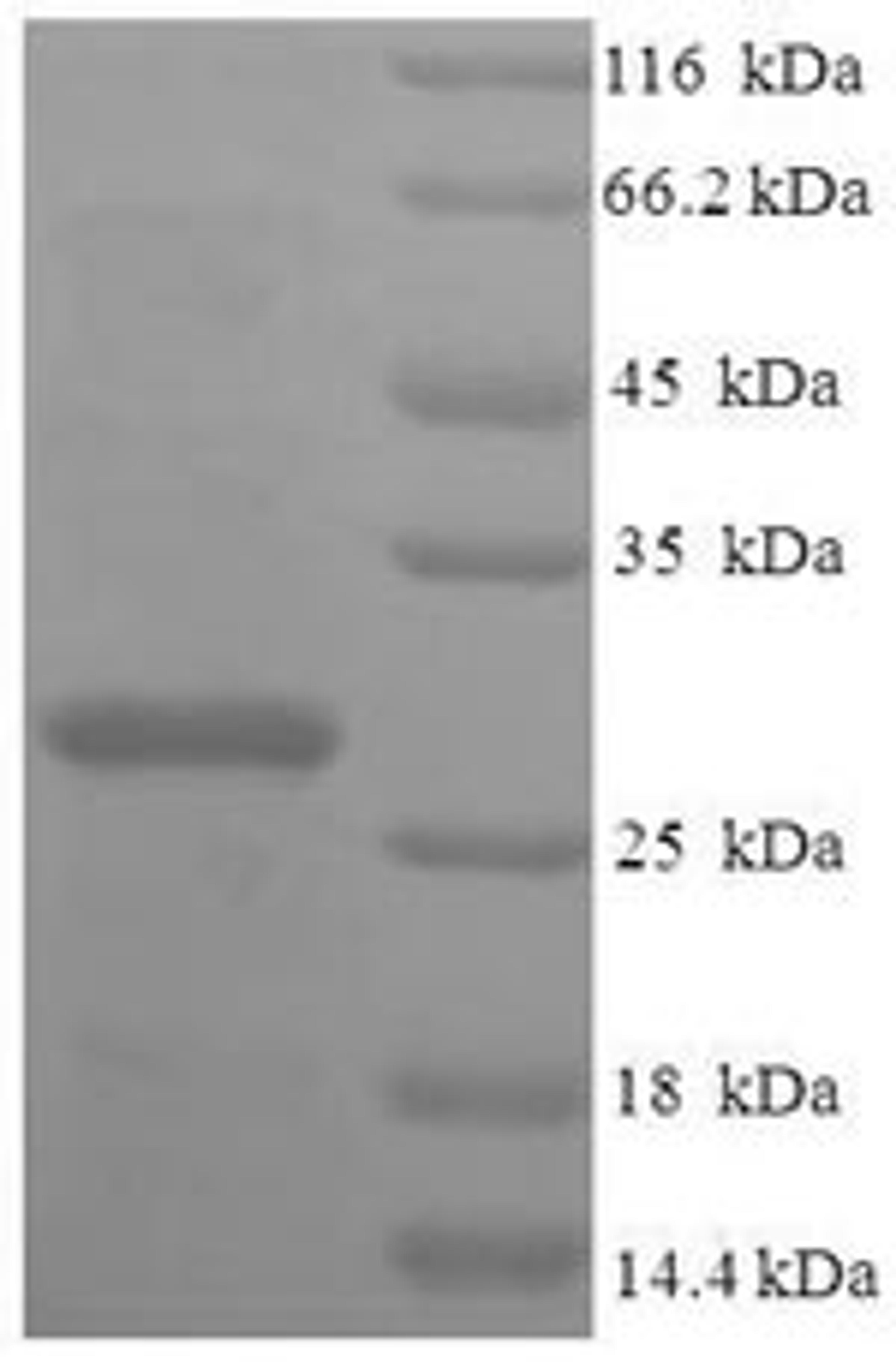 (Tris-Glycine gel) Discontinuous SDS-PAGE (reduced) with 5% enrichment gel and 15% separation gel.