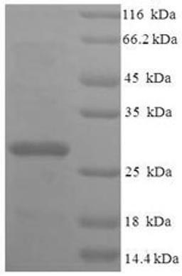 (Tris-Glycine gel) Discontinuous SDS-PAGE (reduced) with 5% enrichment gel and 15% separation gel.