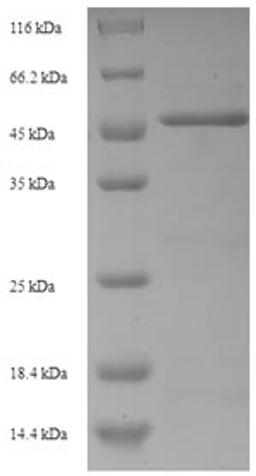 (Tris-Glycine gel) Discontinuous SDS-PAGE (reduced) with 5% enrichment gel and 15% separation gel.