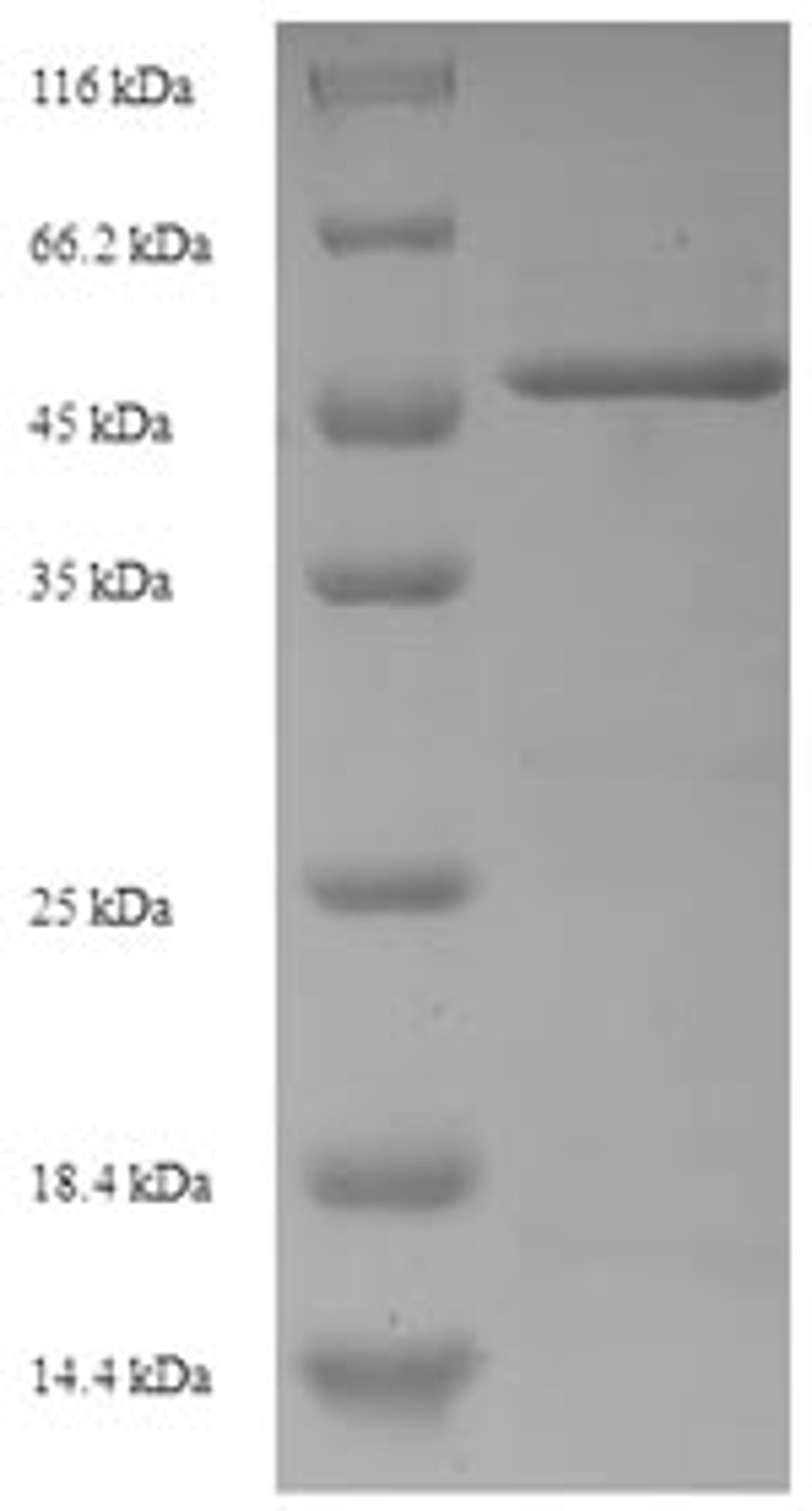 (Tris-Glycine gel) Discontinuous SDS-PAGE (reduced) with 5% enrichment gel and 15% separation gel.