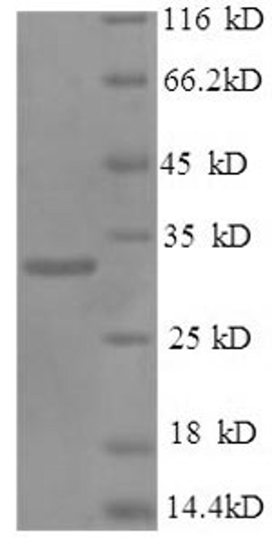 (Tris-Glycine gel) Discontinuous SDS-PAGE (reduced) with 5% enrichment gel and 15% separation gel.