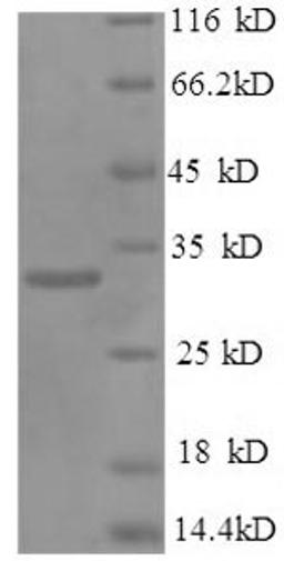 (Tris-Glycine gel) Discontinuous SDS-PAGE (reduced) with 5% enrichment gel and 15% separation gel.