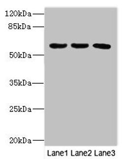 Western blot. All lanes: PIK3R3 antibody at 3.5ug/ml. Lane 1: MCF-7 whole cell lysate. Lane 2: Jurkat whole cell lysate. Lane 3: Mouse gonadal tissue. Secondary. Goat polyclonal to rabbit IgG at 1/10000 dilution. Predicted band size: 55, 48, 44 kDa. Observed band size: 55 kDa. 