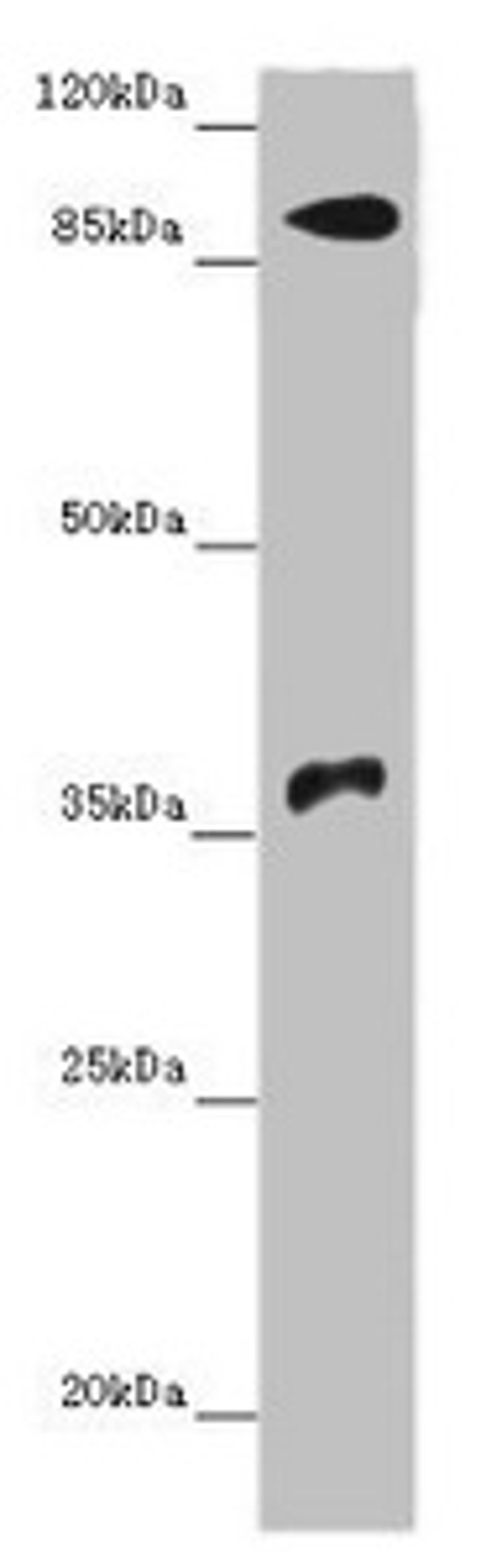 Western blot. All lanes: DNMT3B antibody at 14µg/ml + Hela whole cell lysate. Secondary. Goat polyclonal to rabbit IgG at 1/10000 dilution. Predicted band size: 96, 94, 87, 81, 89, 95, 78, 82 kDa. Observed band size: 96, 37 kDa