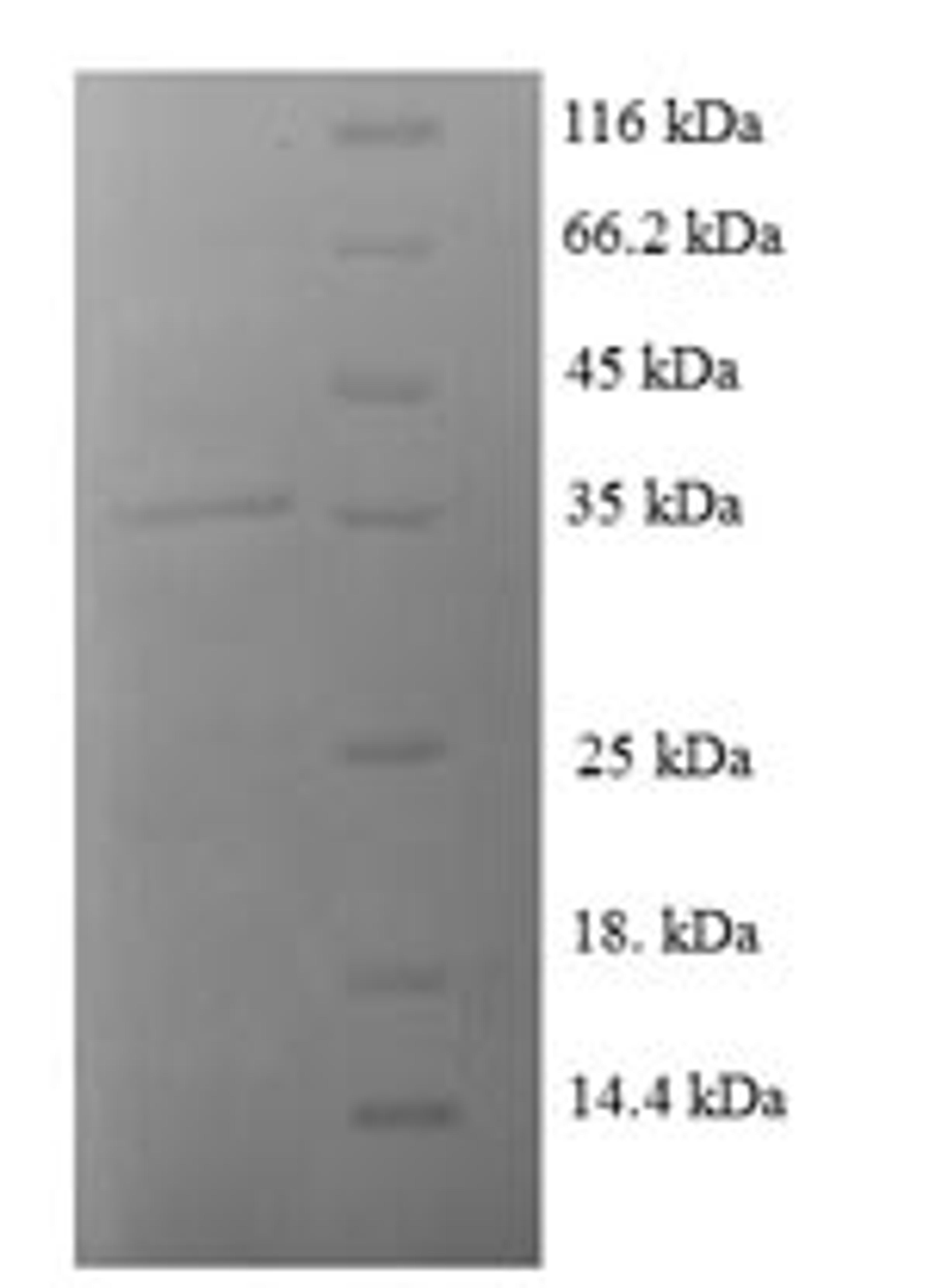 (Tris-Glycine gel) Discontinuous SDS-PAGE (reduced) with 5% enrichment gel and 15% separation gel.