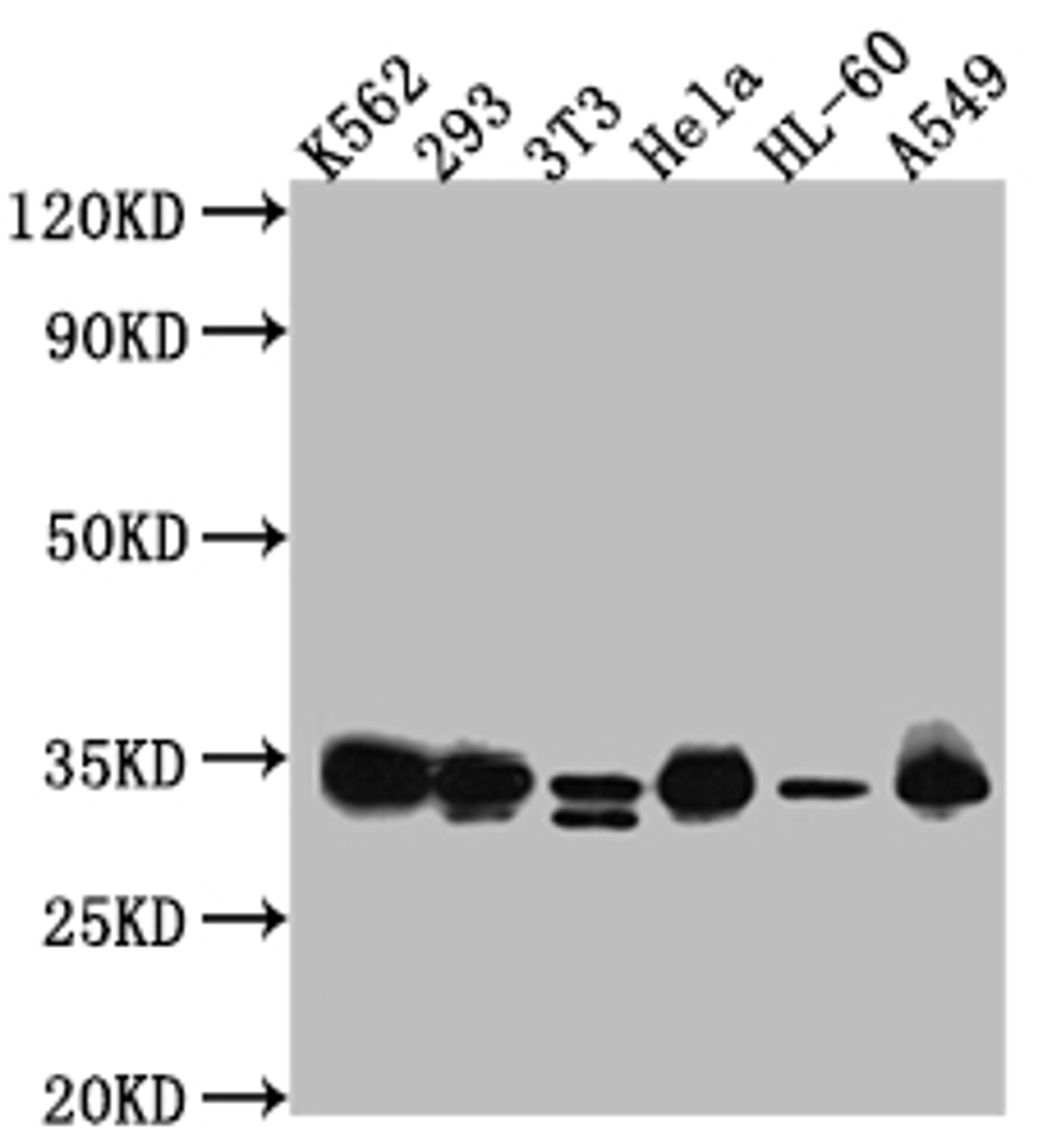 Western Blot. Positive WB detected in: K562 whole cell lysate, HEK293 whole cell lysate, NIH/3T3 whole cell lysate, Hela whole cell lysate, HL-60 whole cell lysate, A549 whole cell lysate. All lanes: CDK2 antibody at 1:1000. Secondary. Goat polyclonal to rabbit IgG at 1/50000 dilution. Predicted band size: 34, 31 kDa. Observed band size: 34 kDa. 