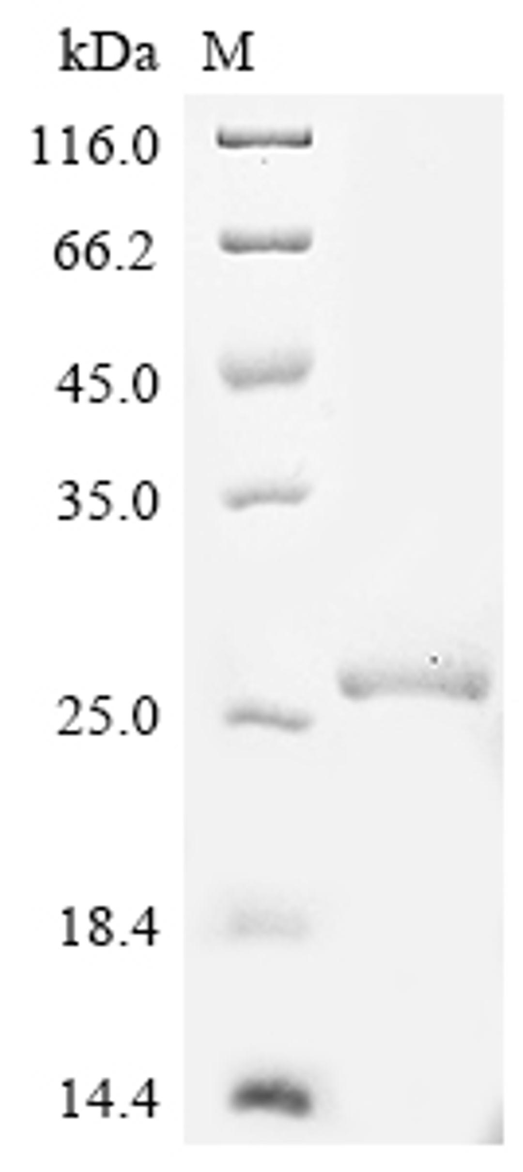 (Tris-Glycine gel) Discontinuous SDS-PAGE (reduced) with 5% enrichment gel and 15% separation gel.