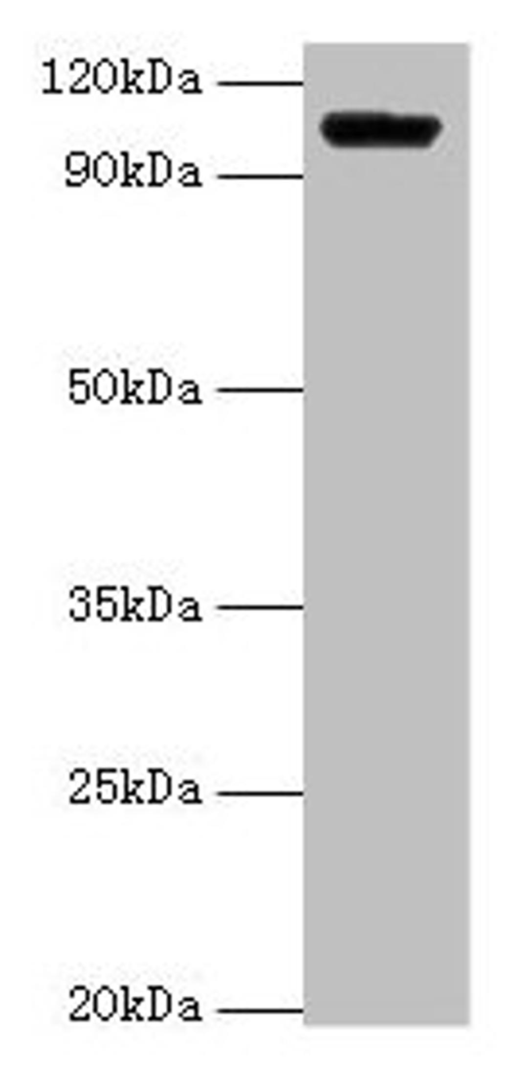 Western blot. All lanes: HK1 antibody at 2µg/ml + Rat brain tissue. Secondary. Goat polyclonal to rabbit IgG at 1/15000 dilution. Predicted band size: 103, 102 kDa. Observed band size: 103 kDa