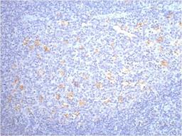 IHC staining of human tonsil tissue, diluted at 1:200.